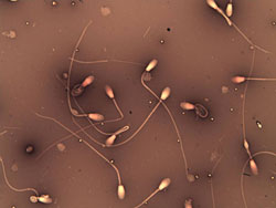 Panel: Semen E & N 1